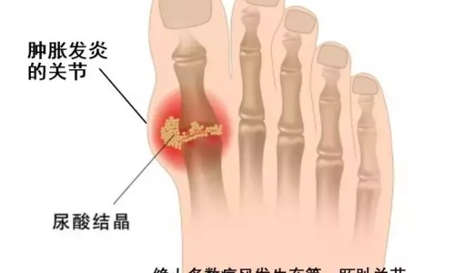 哮喘病人能吃煮玉米吗好吗-哮喘病人能吃煮玉米吗网 - 有哮喘可以吃粥吗,哮喘可以吃糯米之类的东西吗
